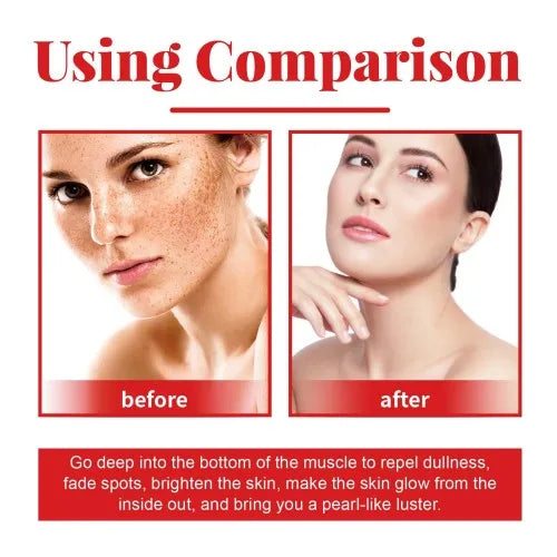 Ouhoe Arbutin Facial Body Essence Gently Firming Repairing Skin Hydrating  Whitening And Anti-Wrinkle